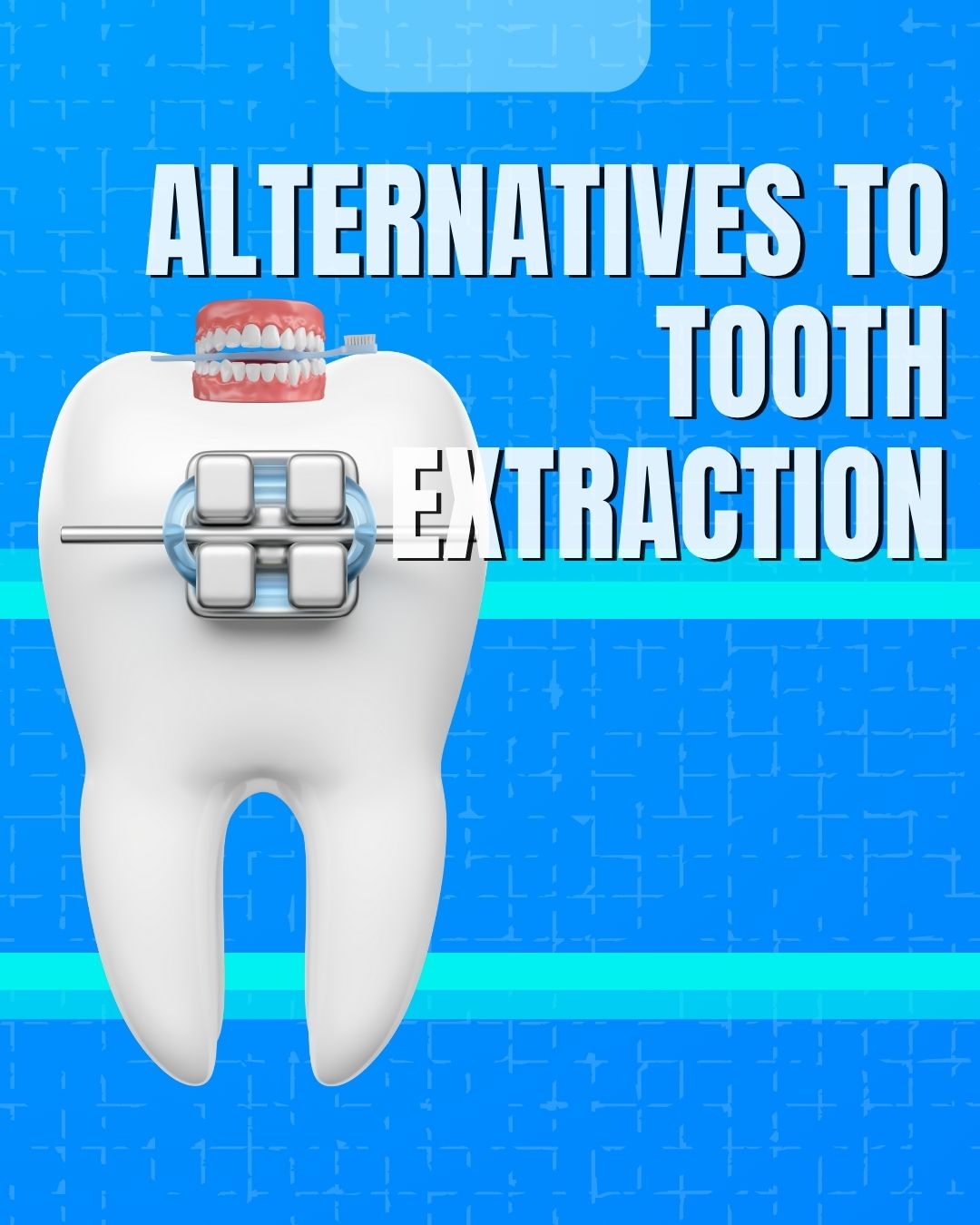 alternatives-to-tooth-extraction